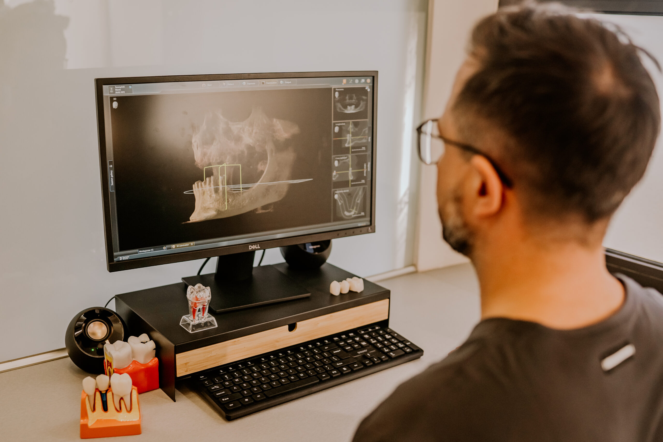 Gabinet dentystyczny Łódź Polesie tomografia komputerowa cbct stomatolog Łódź dental central